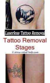 A tattoo removal laser can offer single or multiple functions. Can Beauticians Do Laser Tattoo Removal How To Remove Permanent Tattoo With Lem Diyper Laser Tattoo Tattoo Removal Tattoo Removal Cream