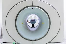 The aims of this study were to characterize myocardial deformation alterations in myocarditis and to determine their relationship with the extent of late gadolinium enhancement. Ressonancia Cardiaca Em Pacientes Recuperados Da Covid 19 Pebmed