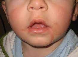 DERMATOLOGY EDUCATIONAL RESOURCE