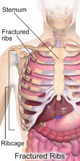 So is part of the heart, the underneath your ribs on the right hand side is your liver. Rib Fracture Physiopedia