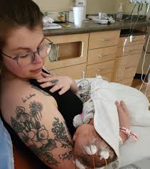 Did your breech baby have any problems with their hips or other  complications from being breech for a long time?