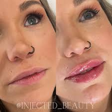 Audrey Crews, APRN, FNP-C