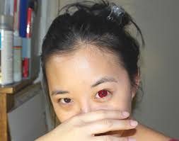 Sharingan Contact Lens By Bkitten On Deviantart A sharingan commission for this one fuses shisui ms with kakashi ms to form his custom version of his eternal sharingan. sharingan contact lens by bkitten on