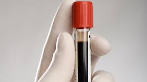 Majoritatea antigenelor de grup sanguin sunt de natură glicoproteică, oarecum stabile din punct de vedere genetic, unele fiind întâlnite la mai multe specii de mamifere în forme identice. DacÄƒ AveÅ£i AceastÄƒ Grupa De Sange Nu FaceÅ£i Acest Lucru VÄƒ Poate Afecta Grav SÄƒnÄƒtatea
