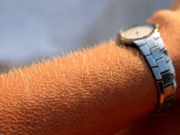 Browse and download minecraft goosebumps skins by the planet minecraft community. Goose Bumps On The Skin Promote Hair Growth Healthmedicinentral
