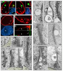 Whenever students face academic hardships, they tend to run to online essay help companies. Nuclear Lipid Droplets And Nuclear Damage In Caenorhabditis Elegans