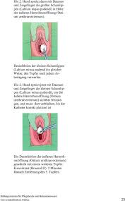 Ausfuhrliche Richtlinie Transurethraler Katheterismus Pdf Kostenfreier Download