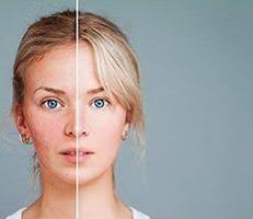 Body Contour Specialist