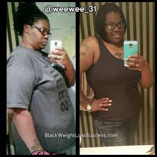 Pin On Before And After Weight Loss Stories