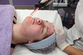 How To Get Rid Of Scars From Impetigo