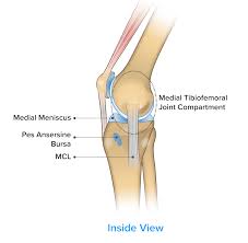 Image result for Knee Bulge Sign