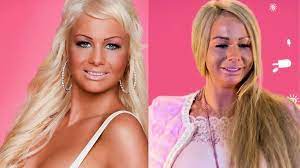 Samantha de jong, beter bekend als barbie, is in verwachting. Wat Heeft Barbie Aan Haar Gezicht Gedaan