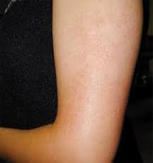 Pin On Fyi Health Beauty Tips