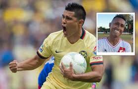 Qué es la esclerodermia? Enfermedad que deterioro a Osvaldo Martínez