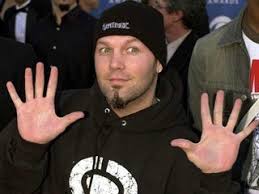 Check spelling or type a new query. Fred Durst Now With Sitcom Called Douchebag Cough Cough Oc Weekly