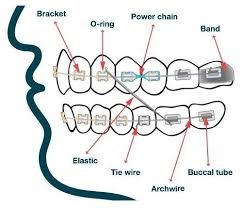 Dentaltown Orthodontic Armamentarium Dental Cosmetics