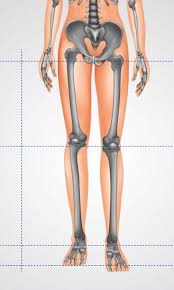 Image result for Functional Leg Length Discrepancy