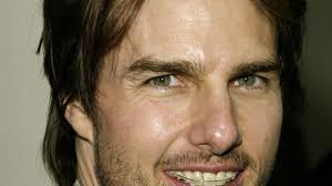 He has received various accolades for his work, including three golden globe awards and three nominations for. Tom Cruise Mit Fester Zahnspange