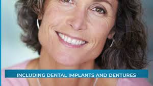 $1 Implant Consult Package