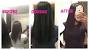 Biotin 10000 Mcg
