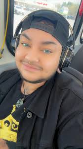 Testosterone and top surgery benefits