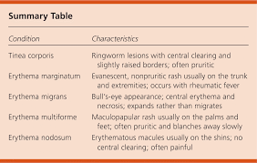 Image result for Erythema Multiforme Causes