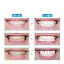 Instant Tool Beauty Light Led Teeth Whitening Life Changing Products