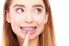 A better smile doesn't have to be out of reach. Average Cost Of Braces Princeton Orthodontics
