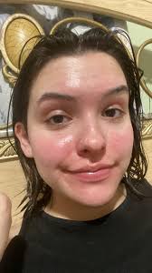 What are some herbal treatments for eczema?