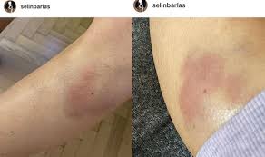 Trt spor ekibinden ferhat konyar, turnuvaya katılan takımlarla ilgili analizler yaptığı sırada bir kadın aniden gelerek konyar'ı yanağından öptü. Trt Spor Yorumcusu Cem Dizdar Dan Evli Oldugu Kadina Siddet Dokuz8 Haber