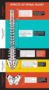 Spinal Cord Injuries Globally Infographic Glance Spinal Cord Injury Spinal Spinal Cord
