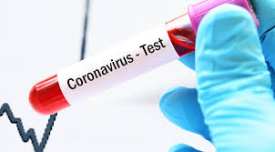 Informationsschreiben zur finanzierung bei quarantäne. Coronavirus In Nrw Aachen Heinsberg Duren Karte Und Zahlen