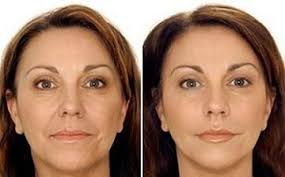 Kelly Corry (janasity)