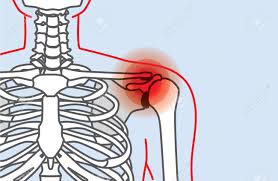 A common cause of shoulder pain is soreness of the tendon (a cord that attaches a muscle to a bone) in the rotator cuff. Outline Of Body And Bone Which Have Shoulder Pain From Lifestyle Royalty Free Cliparts Vectors And Stock Illustration Image 50016421