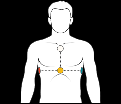 Kardía, deutsch ‚herz', und γράμμα. Ekg Gerat Fur S Smartphone Mobiles Ekg Cardiosecur