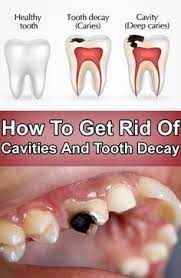 Pin On Why Is Oral Health Care Important