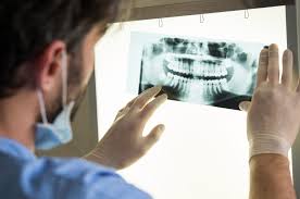 They also accept medicaid and other insurance. What Every Patient Needs To Know About Dental X Rays And Safety The Super Dentists