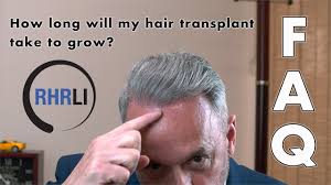 1% of patients start growing hair immediately after the procedure. How Long Will My Hair Transplant Take To Grow Faq Youtube