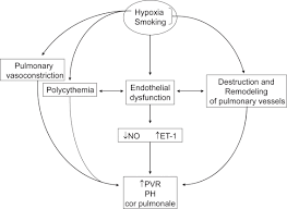 Pathophysiology Of Cor Pulmonale In Copd Abbreviations No Nitric Download Scientific Diagram