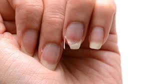 Comment Avoir De Beaux Ongles Naturellement Voila 6 Secrets De Mamie Avoir De Beaux Ongles Reparer Un Ongle Casse Soin Des Ongles