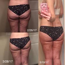 Pin On Fasciablaster Transformations