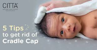Image result for Cradle Cap