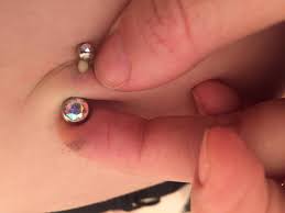 Buy Infected Belly Button Piercing Treatment Off 51