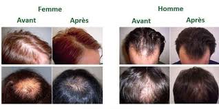 Epingle Sur Beaute