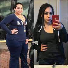 Sagging skin is commonly caused by pregnancy, significant weight loss (including gastric bypass surgery), sun damage, aging, and even genetics. Gastric Bypass Surgery Before And After Pictures Past Patient Photos