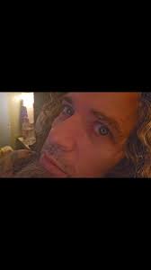 Hey, it's @renee_sadora here at "The Healing Center," and today is 2 weeks  since the surgery. Johnny is still in bed in and out of naps. He is pretty  sedated and following the doctor's orders, laying ...