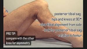Image result for PCL Sulcus Test