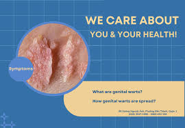 Image result for genital warts