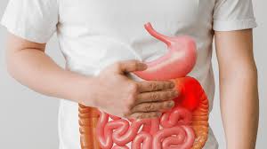 Câncer de intestino: frequente, porém tratável - Olhar da Saúde