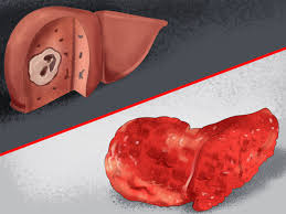 Numerous variants of the clinical course are summarized in three main forms. How To Diagnose Liver Disease In Older Dogs 9 Steps